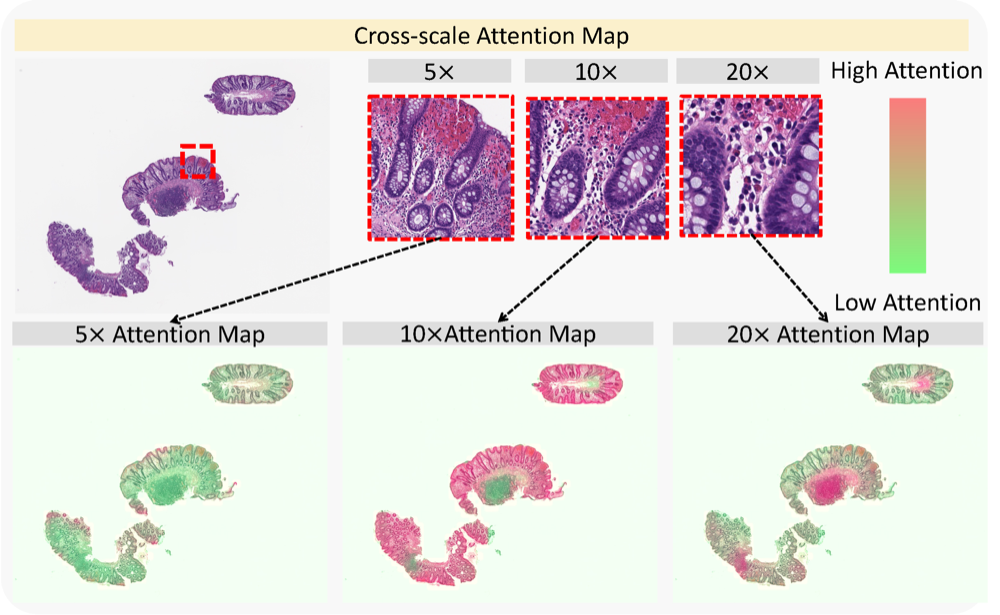 AttentionMap.png